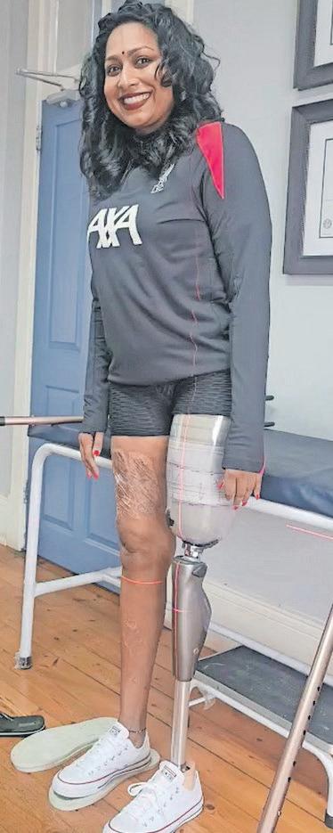 From tragedy to triumph: Trish Naidoo's story of resilience after losing her leg