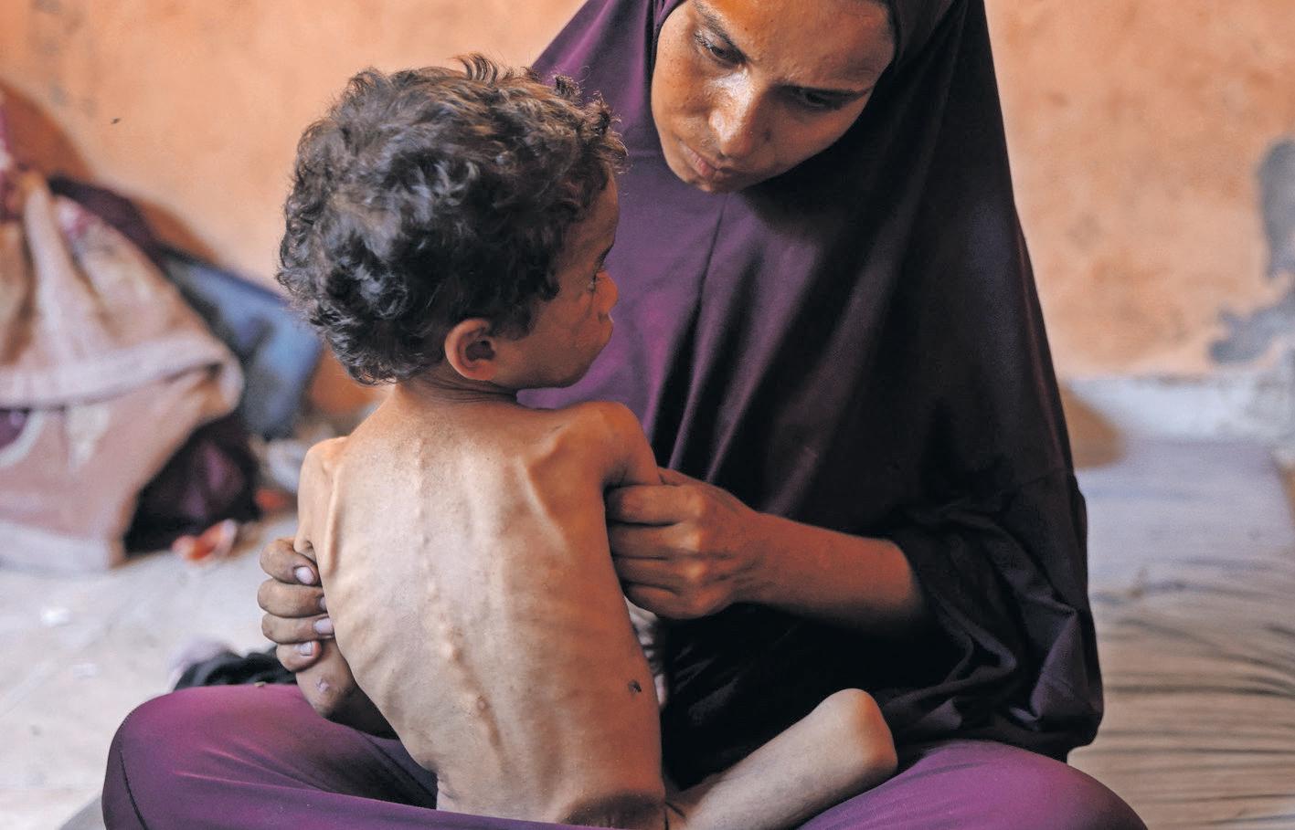 Deaths from hunger rise in Gaza