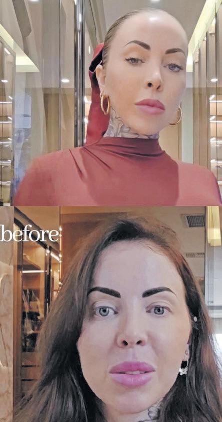 How Jojo Robinson is changing the narrative on cosmetic procedures