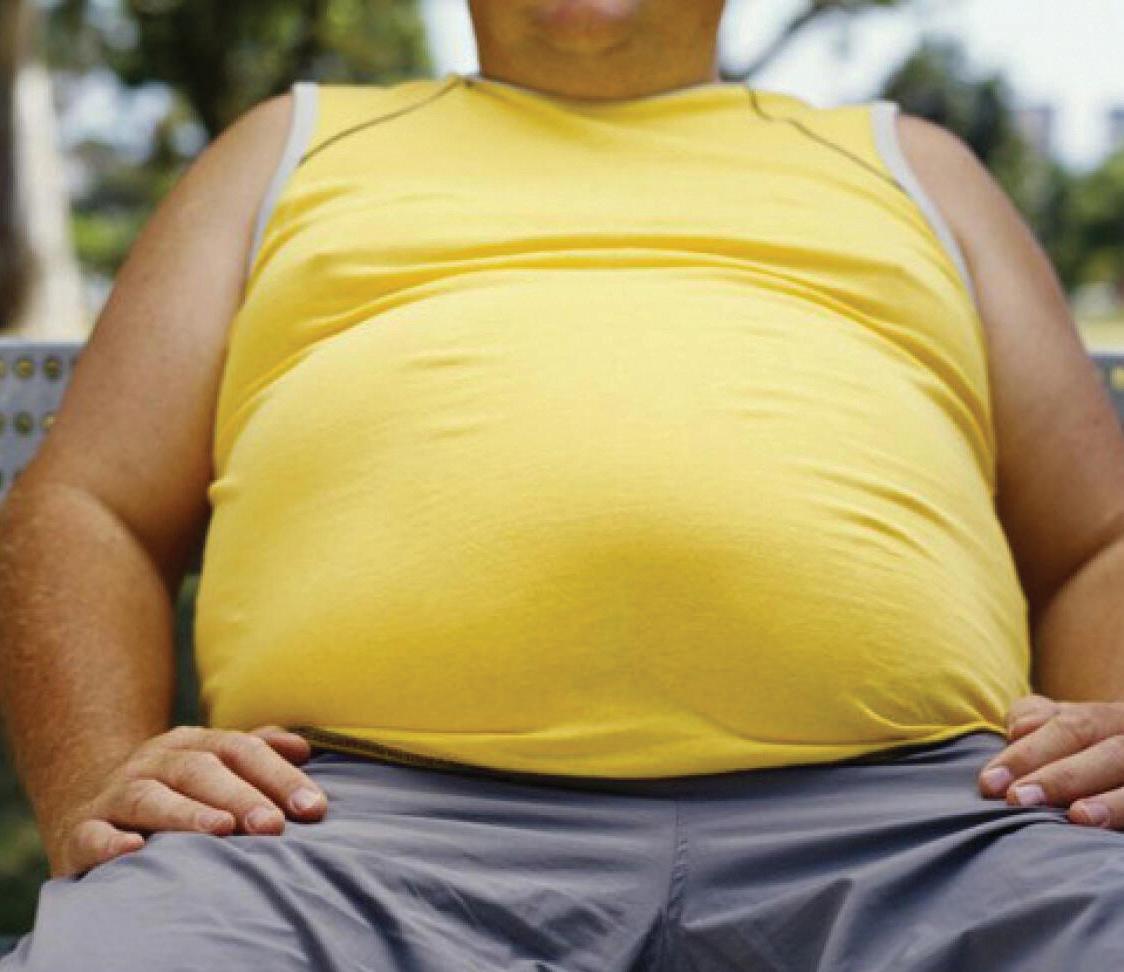 UAE's obesity rate 'to be highest' globally by 2050
