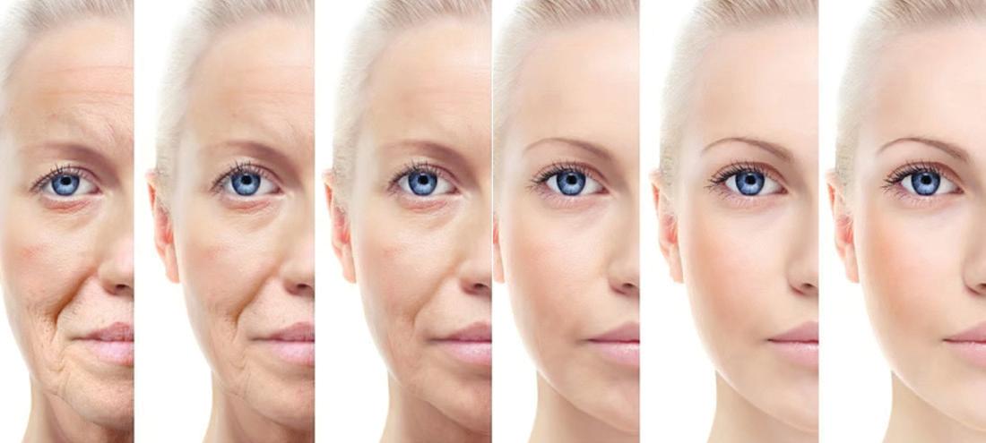 Surgeons warn about 'cheap' cosmetic surgery fixes