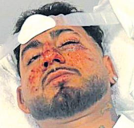'Racist assault' leaves Mohali man hospitalised in Australia
