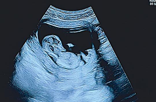 Pete Davidson is going to be dad, expecting first child with girlfriend