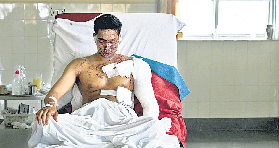 Doctors recall horrors of blast