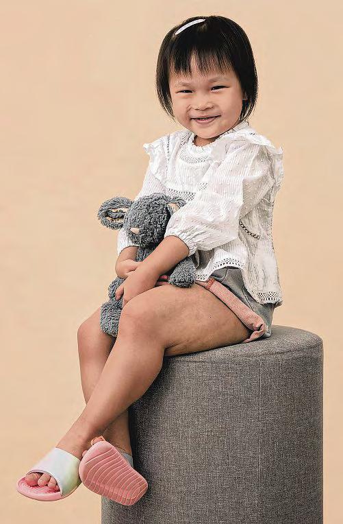 Her left leg is much bigger than her right due to gene mutation