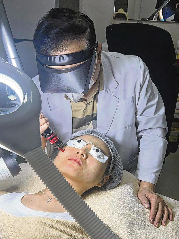 Laser treatments: Get regimen tailored for your skin