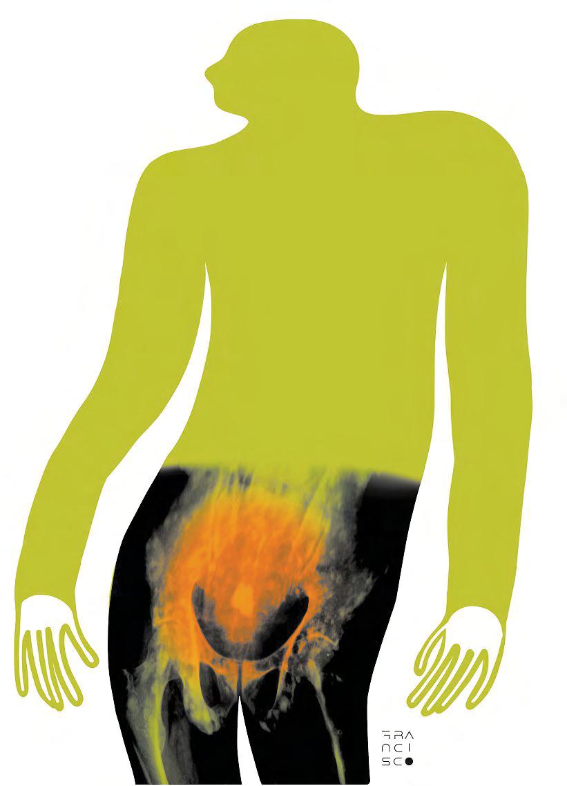 Doc Talk Should you screen for prostate cancer?