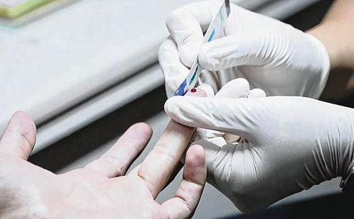 151 new HIV cases in 2024; first time since 1998 number is below 200