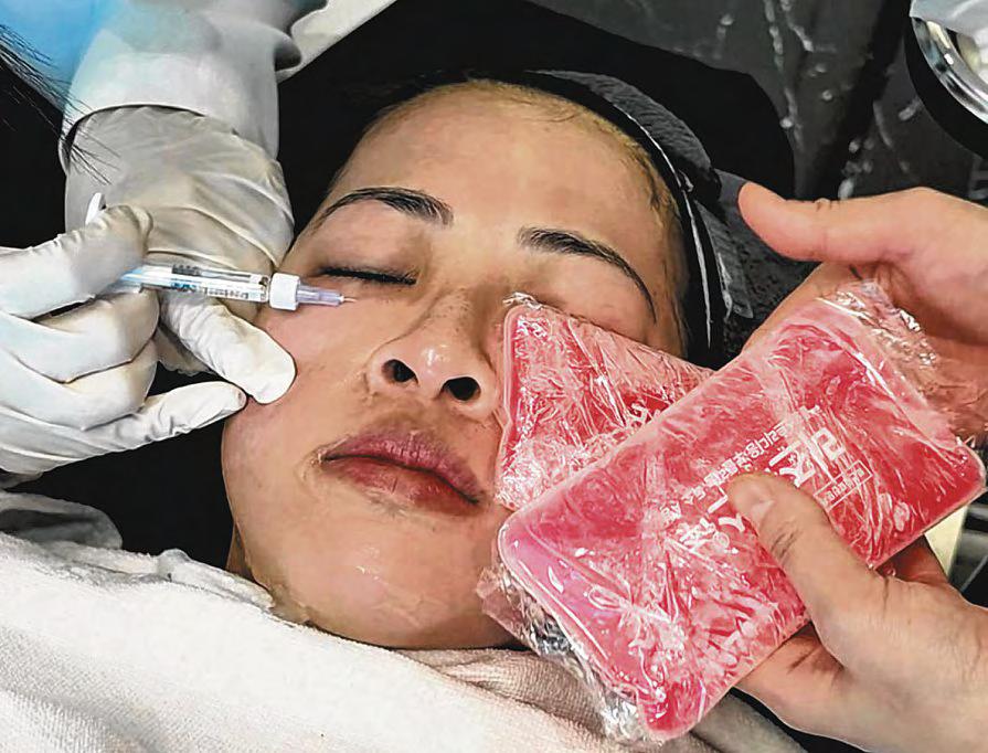 More Singaporeans in their 20s and 30s going for Botox and collagen shots