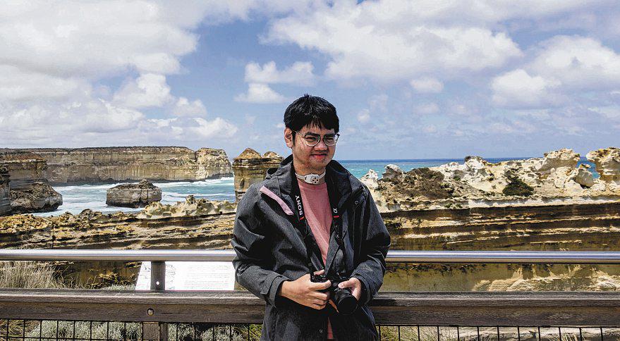 A fighter till the end: Man who survived acid attack as a baby dies of cancer at 26