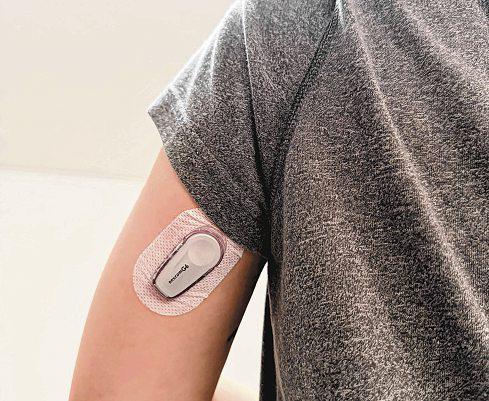 Patients with rarer types of diabetes can get subsidy for monitoring device