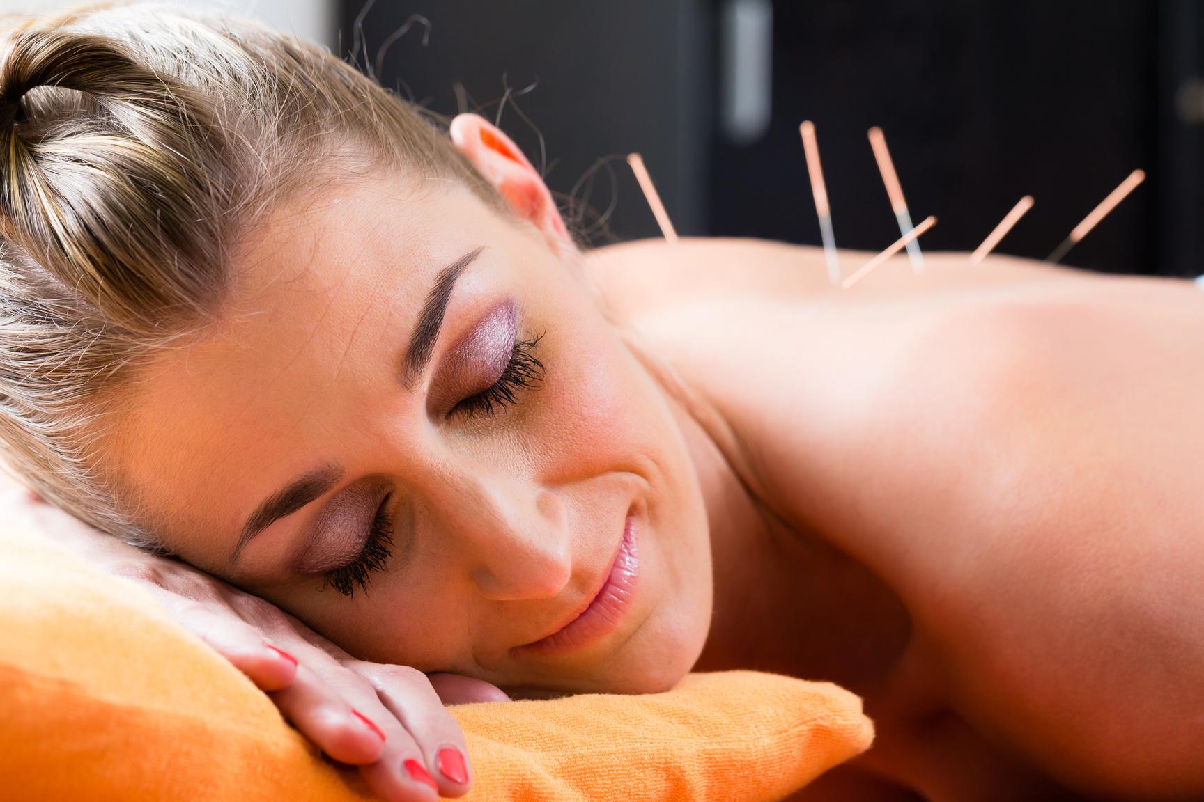 HOW DRY NEEDLING ACCELERATES RECOVERY FOR ATHLETES