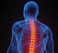NSAID drugs seen as best for back pain