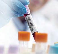 'Universal' blood test for cancers