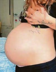 Star Jesy's fella tells of emergency surgery op