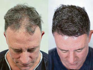 THIN IT'S ALL OVER... IT'S NOT NOW