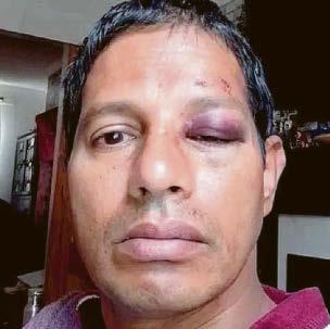 Beaten and robbed on his way to work