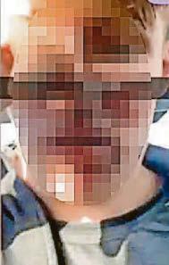 Shock footage of 'attack' on teenage boy