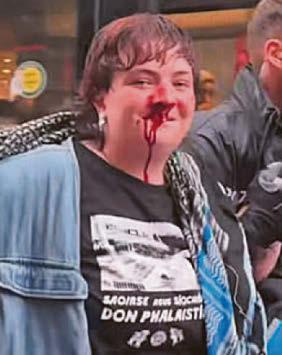 Protester fears injury permanent