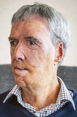 My 3D printed face...