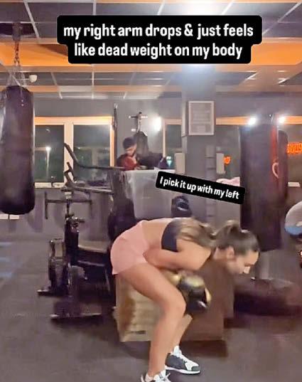 The moment I had a stroke... at age 30