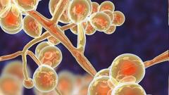 Surveillance, R&D innovation and communication are key levers for India to lead the fight against AMR