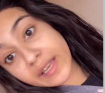 How this woman suffering from a rare condition causing 'water allergy