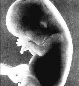 All you need to know about: Foetal abnormalities