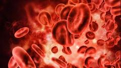 Rising cases of COVID-19 bring to fore associated threat of deep vein thrombosis