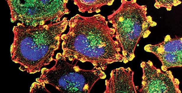 టానింగ్ బెడ్లతో చర్మ క్యాన్సర్ ప్రమాదం