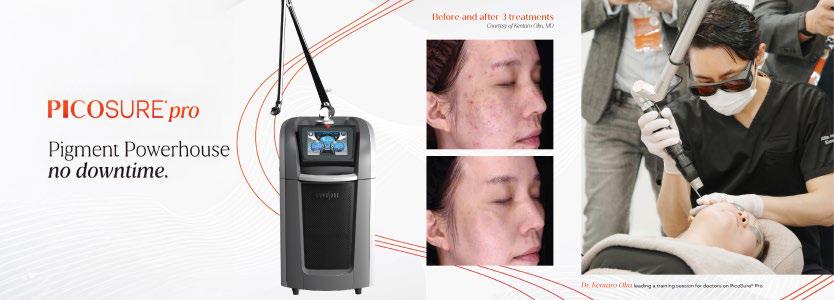 Award-Winning Innovation: PicoSure® Pro Sets New Benchmark in Picosecond Laser Technology