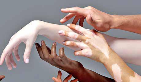 NO HEALTH WITHOUT SKIN HEALTH: A GLOBAL CALL TO END SKIN BLEACHING AND PRIORITISE DERMATOLOGICAL EQUITY