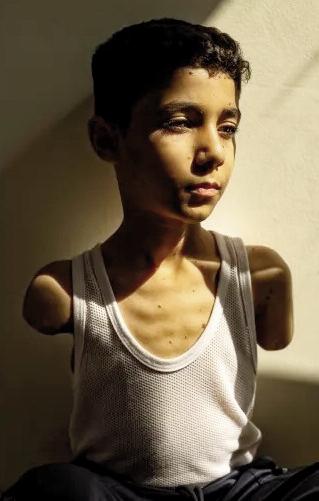 Portrait of amputee Palestinian boy from Gaza wins World Press Photo award