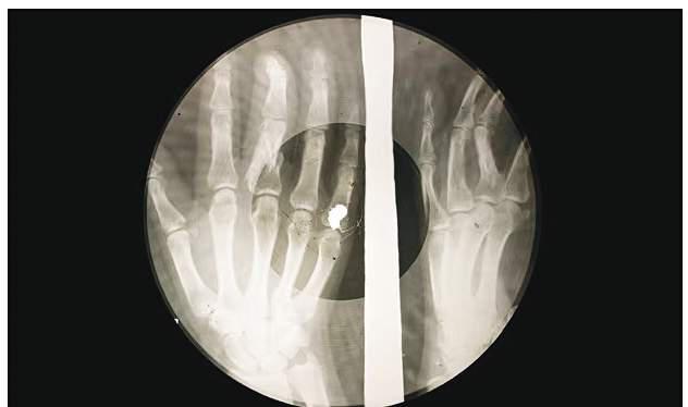 When Elvis and Ella were pressed onto X-rays – subversive legacy of Soviet 'bone music'