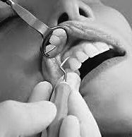 Professional teeth cleaning