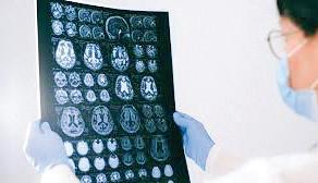Diet and lifestyle influence chances of age-related brain disorders