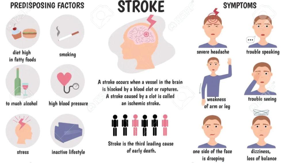 Rising stroke cases among young Indians need for AI-enabled screening