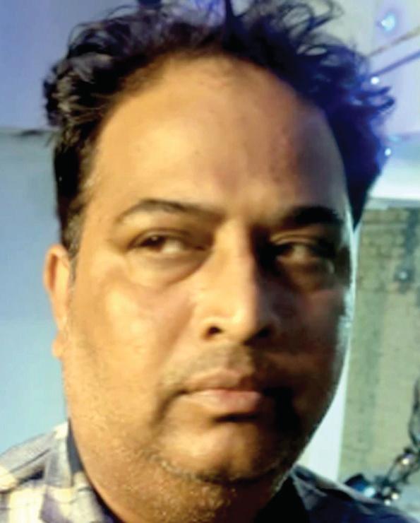 Delhi: Father arrested for conspiracy in ‘staged’ acid attack on his daughter