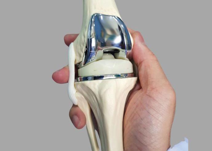 What will be life after joint replacement?