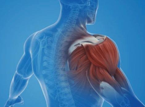 Muscle Spasms: Causes, symptoms, and effective remedies