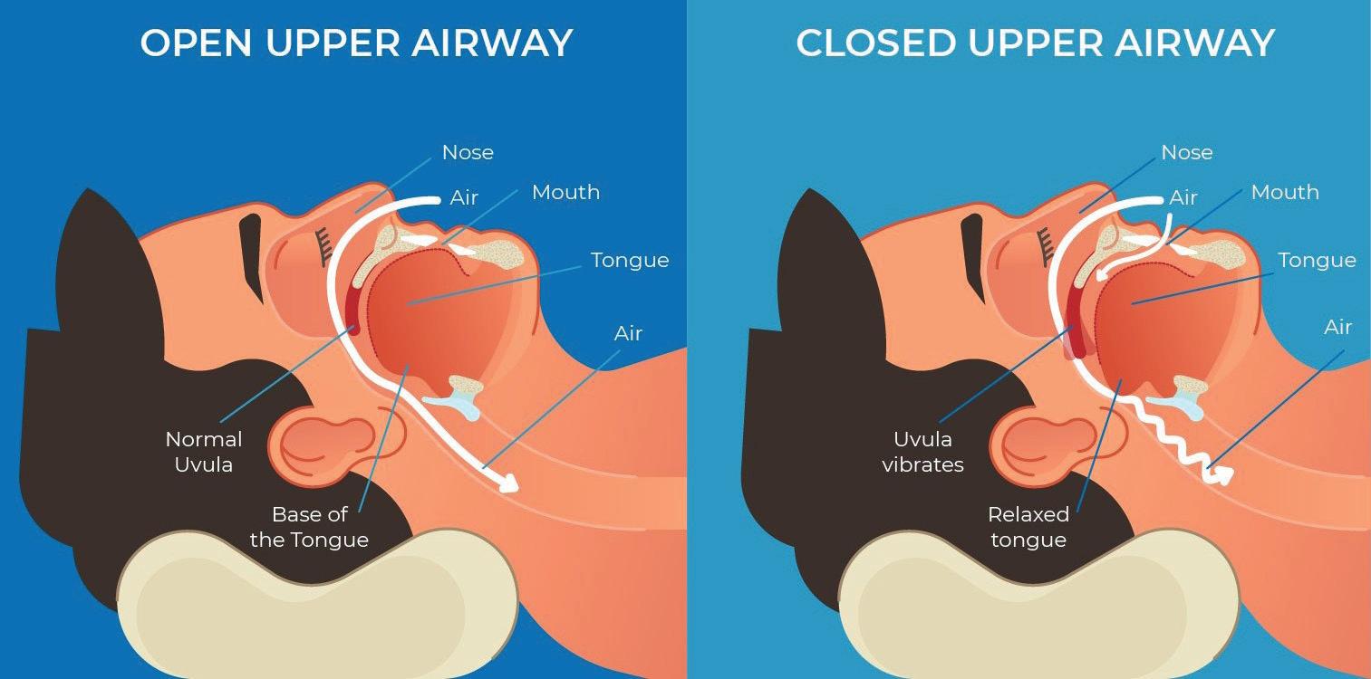 SNORING AND SLEEP HEALTH: CAUSES, SYMPTOMS, AND NATURAL CARE