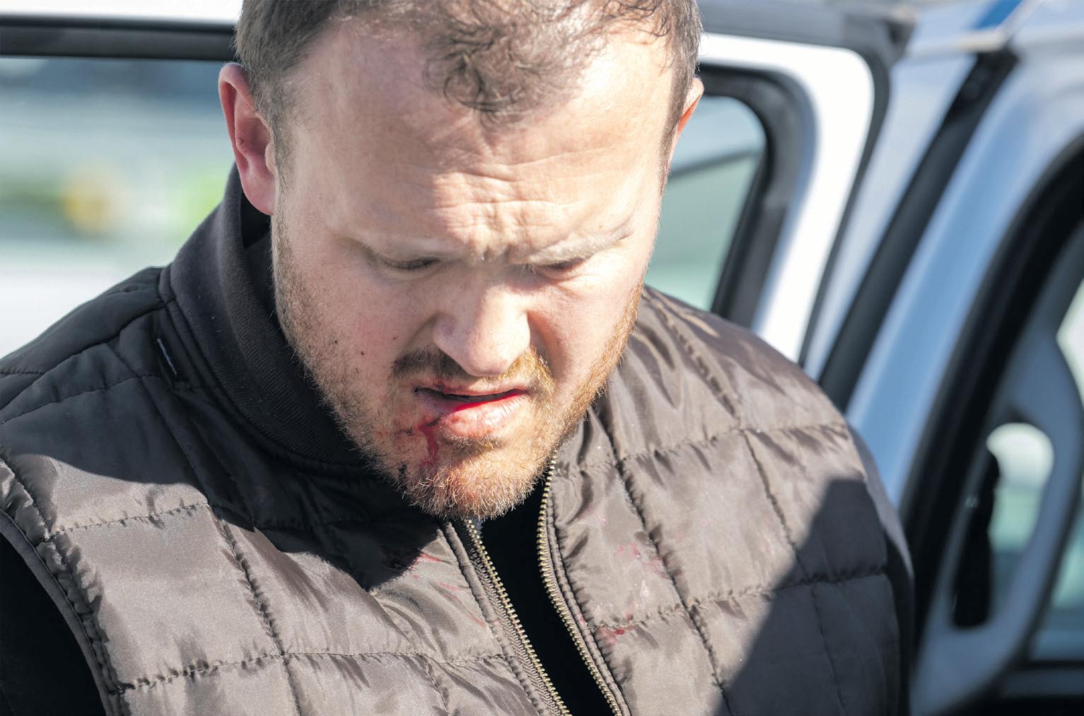 MP Ian Cameron defends firearm use after Philippi attack