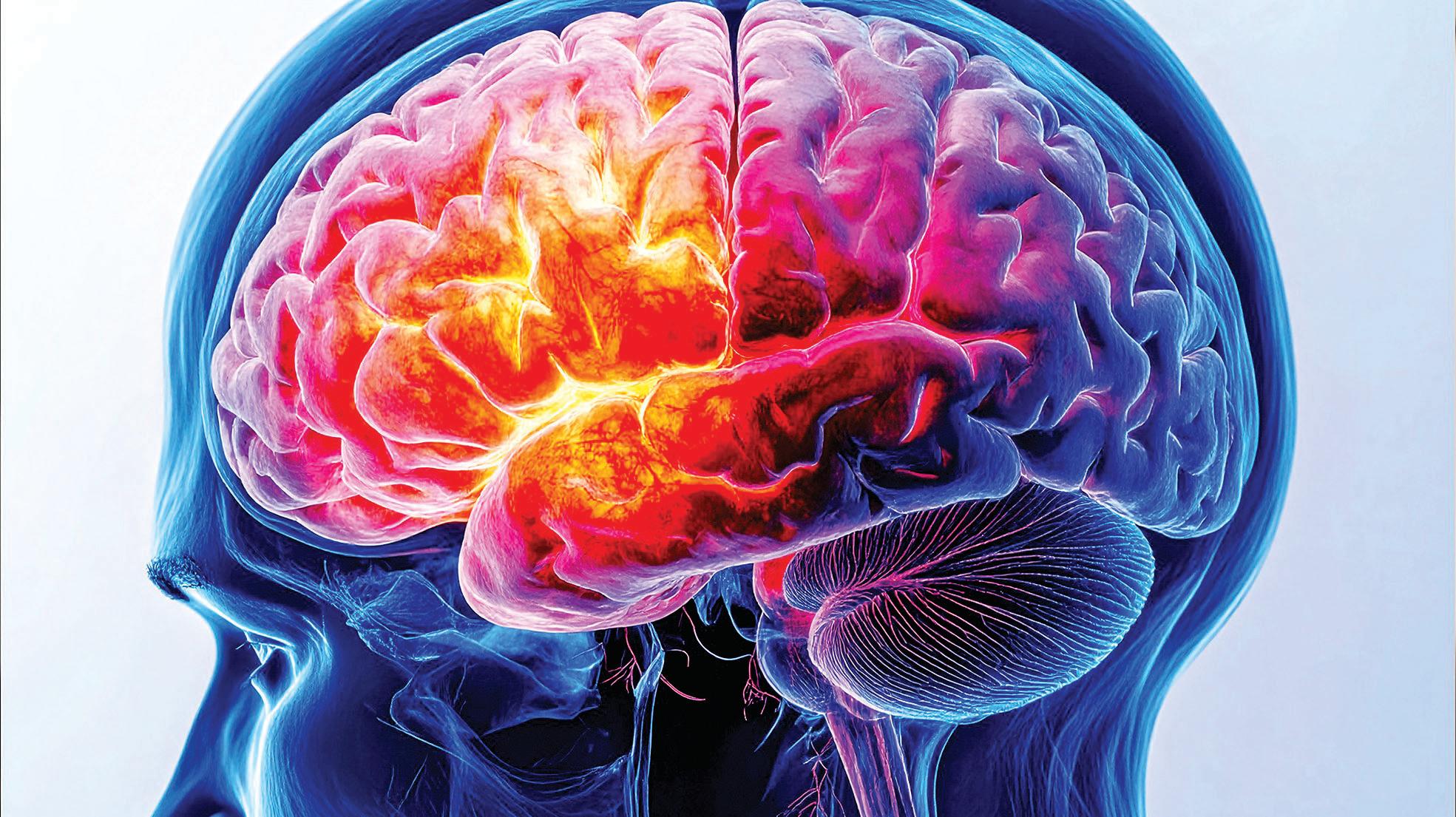 Autistic Patients at High Risk of Parkinson's Disease: Study