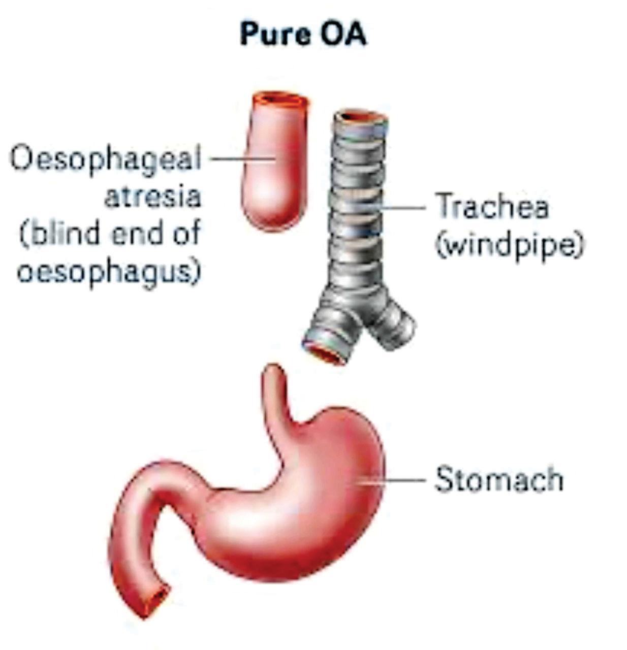 Civil docs help toddler finally taste food
