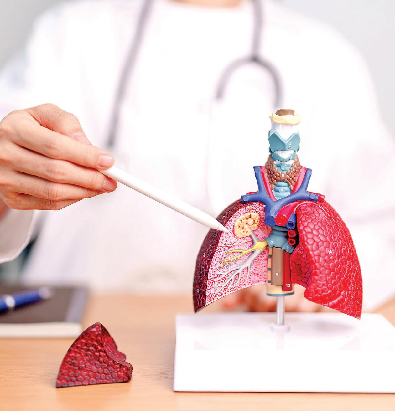 Study estimates 14 pc of adults aged 45 and above may have obstructive lung disease