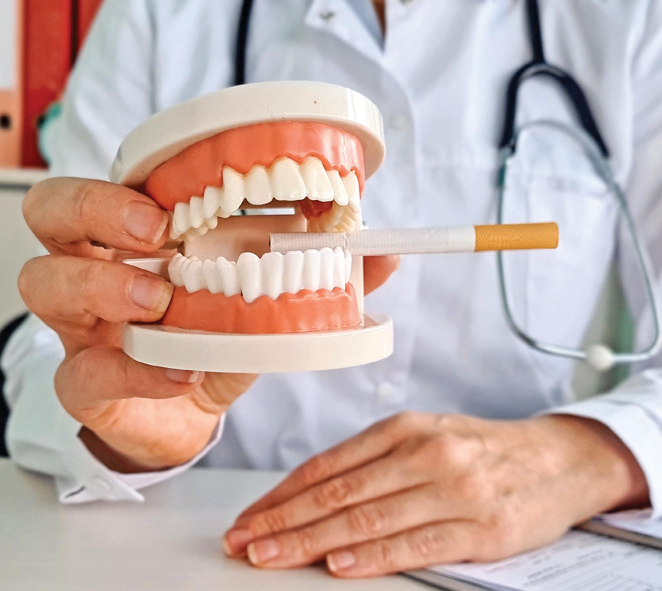 Awareness about oral cancer lacking in country: study