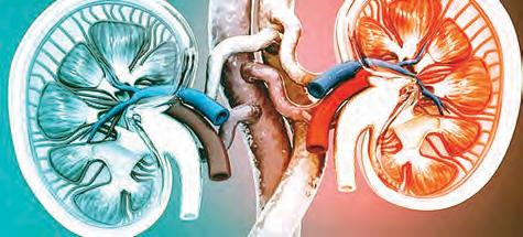 Blood type incompatibility key factor for kidney exchange transplant in India, finds study