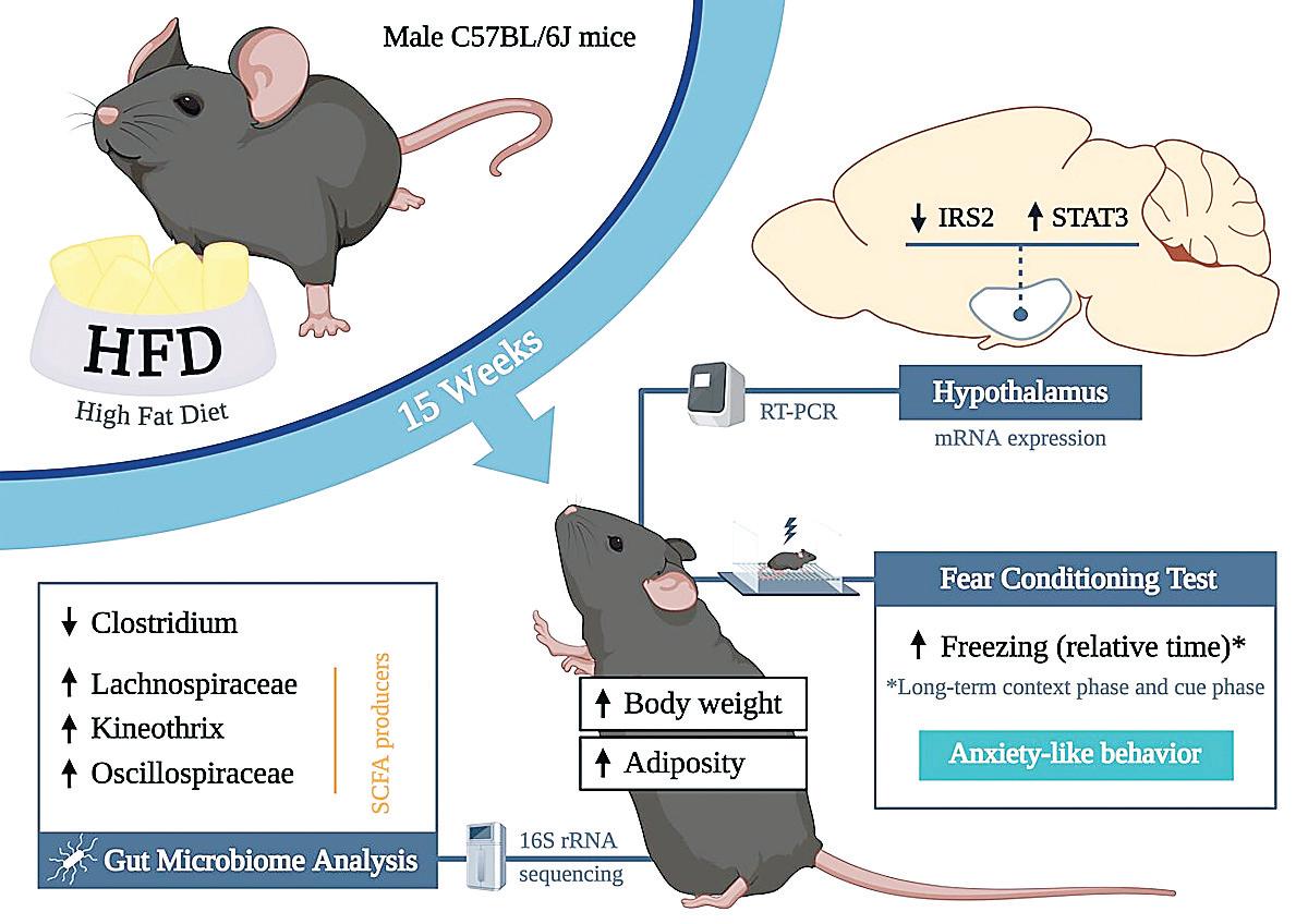 Study suggests obesity contributes to anxiety, cognitive impairment