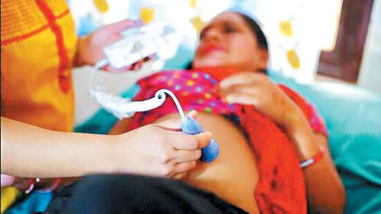 CMOs directed to reverse track abortions of upto 24 weeks of pregnancy
