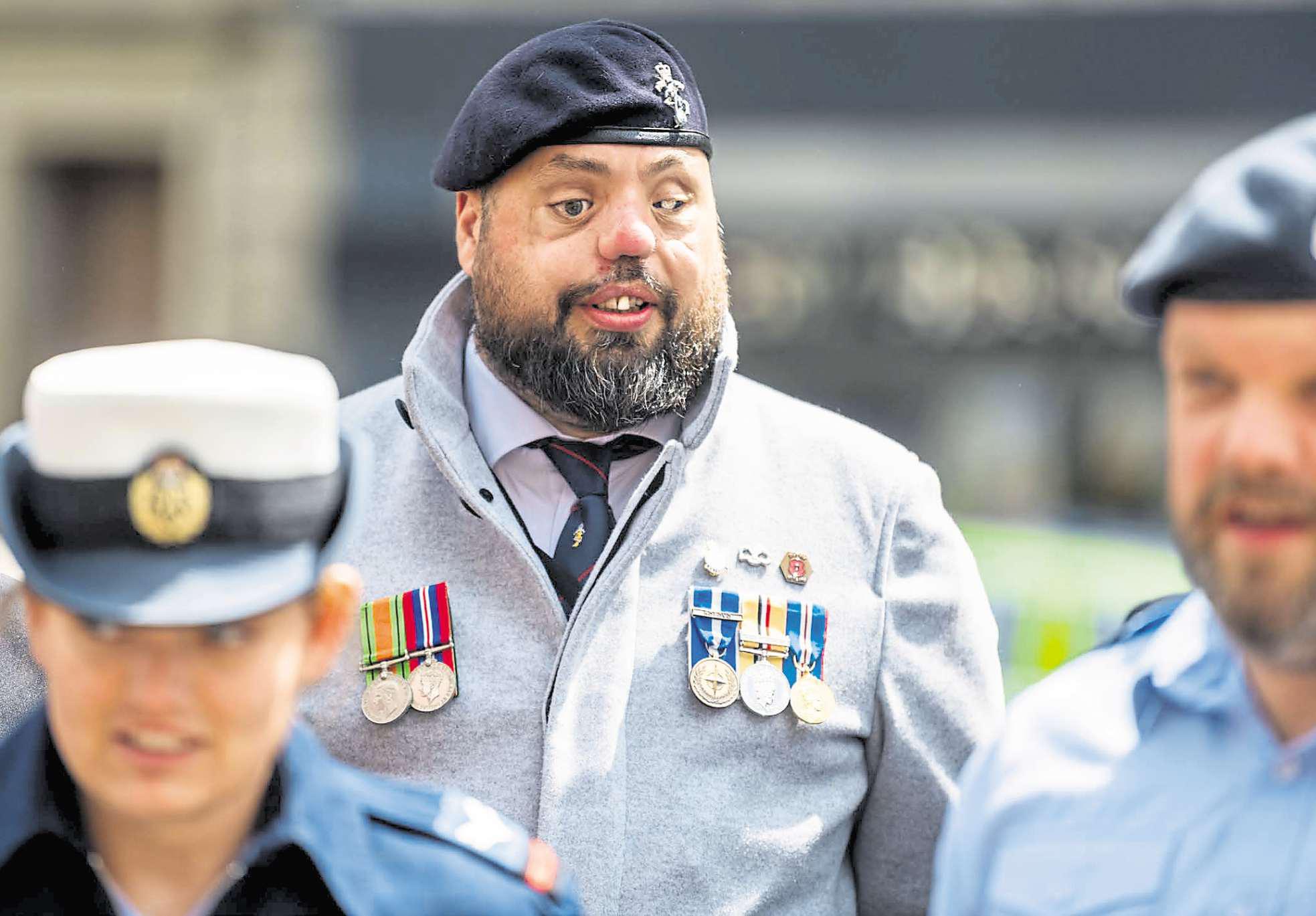 Simon finds the positives in war injury to help others